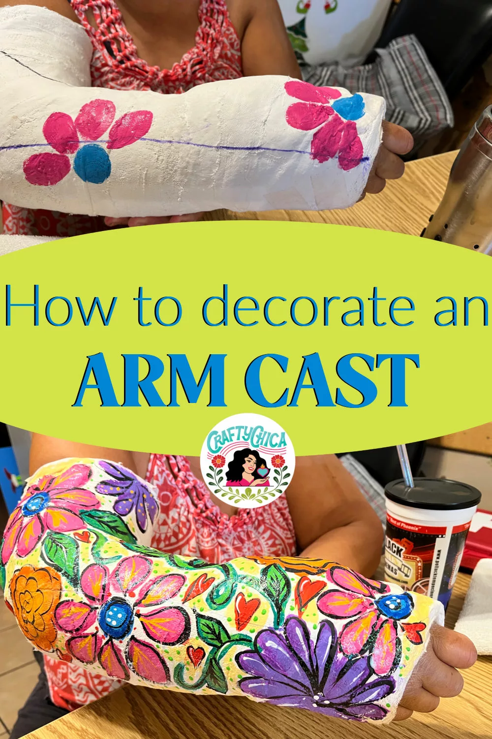 how to decorate an arm cast-